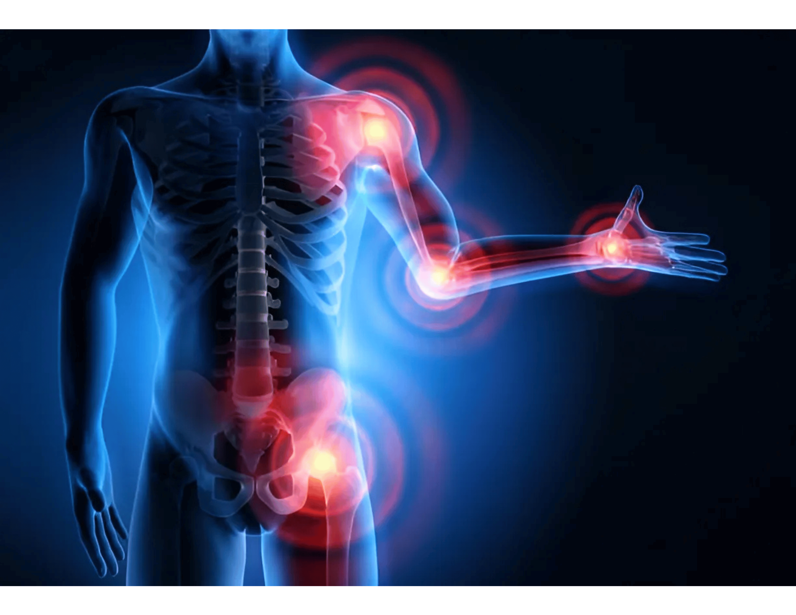 Rheumatoid arthritis symptoms include joint pain and stiffness